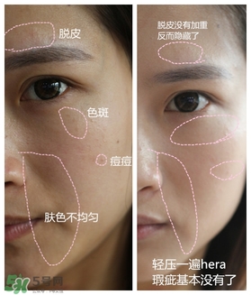 赫拉氣墊用了悶痘嗎？赫拉氣墊悶痘怎么辦？