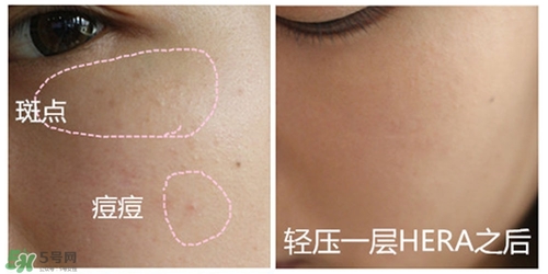 赫拉氣墊用了悶痘嗎？赫拉氣墊悶痘怎么辦？