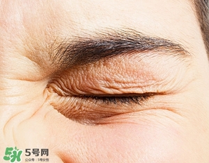 去皺最好的方法 最有效的去皺方法