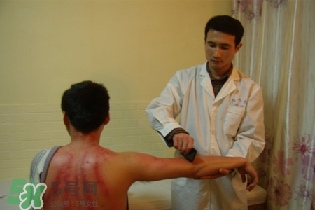 骨質(zhì)疏松可以刮痧嗎？骨質(zhì)疏松刮痧好嗎？