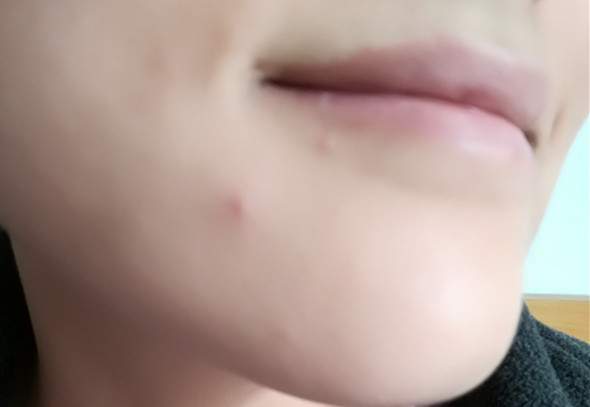 美康粉黛適合什么年齡？美康粉黛適合年齡段