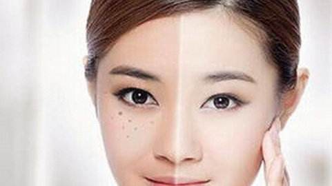 激光祛斑有副作用 激光祛斑有什么副作用嗎 激光祛斑有副作用 激光祛斑有什么副作用嗎