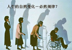 哪些人容易得骨質疏松癥？骨質疏松的高發(fā)人群有哪些？