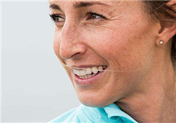 老年斑是怎么形成的？老年斑的形成原因