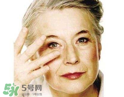 老年斑是怎么形成的？老年斑的形成原因