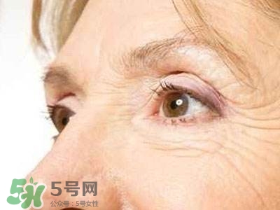 老年斑是怎么形成的？老年斑的形成原因