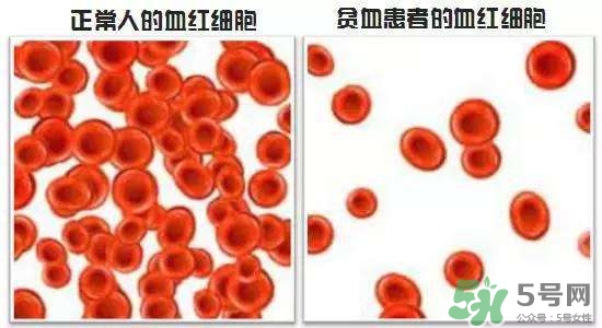 缺鐵性貧血的癥狀 缺鐵性貧血的癥狀有哪些？