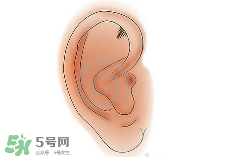 中耳炎有什么癥狀？中耳炎的癥狀表現(xiàn)