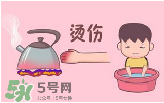 燙傷可以用牙膏嗎？燙傷用牙膏管用嗎？