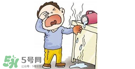 燙傷可以用牙膏嗎？燙傷用牙膏管用嗎？