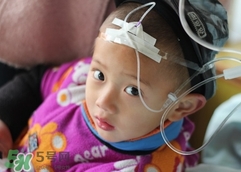 猩紅熱要打幾天吊針?猩紅熱要打幾天點(diǎn)滴? 猩紅熱要打幾天吊針?猩紅熱要打幾天點(diǎn)滴?