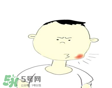 嘴角起泡是什么原因？嘴角起泡怎么辦？