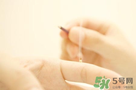 艾灸可以減肥嗎？艾灸減肥的穴位方法介紹