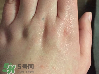 薇諾娜適合什么皮膚？薇諾娜適合敏感肌嗎？