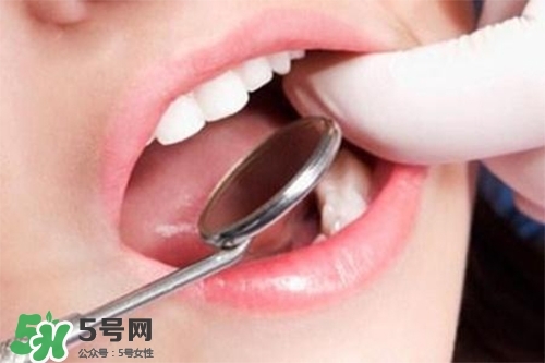 口腔異味是怎么回事？口腔異味怎么清除？