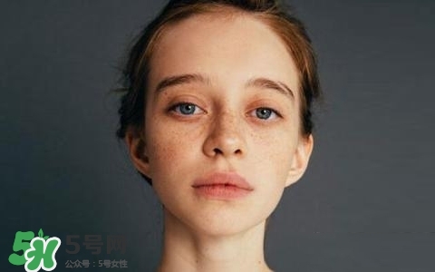 長斑是什么原因引起的？祛斑效果最好的方法