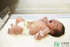 病理性黃疸孩子有何癥狀 病理性黃疸的特點 病理性黃疸孩子有何癥狀 病理性黃疸的特點