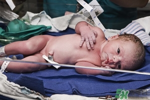 病理性黃疸孩子有何癥狀 病理性黃疸的特點 病理性黃疸孩子有何癥狀 病理性黃疸的特點