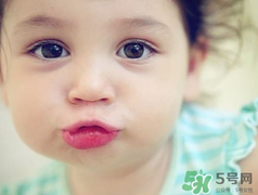 孕期可以激光祛斑嗎？懷孕了能做激光祛斑嗎？