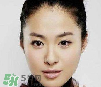 如何預(yù)防臉上長痣？怎樣預(yù)防臉上長痣