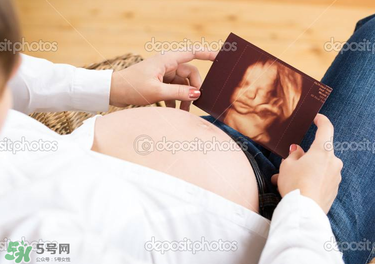 橄欖油真的可以預(yù)防妊娠紋嗎？橄欖油真的可以去妊娠紋嗎？