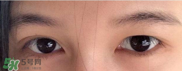 眼睛發(fā)黃是怎么回事？眼睛發(fā)黃是什么原因