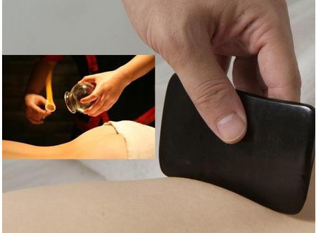 刮痧之后可以拔罐嗎？刮痧之后可不可以拔罐