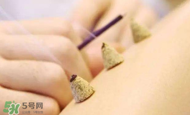 剛懷孕可以艾灸嗎？剛懷孕可以艾灸腹部嗎