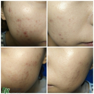 愛敬氣墊適合什么膚質(zhì) 愛敬水粉霜適合什么膚質(zhì) 愛敬氣墊適合什么膚質(zhì) 愛敬水粉霜適合什么膚質(zhì)