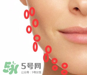 nuface美容儀有效嗎？nuface美容儀副作用？