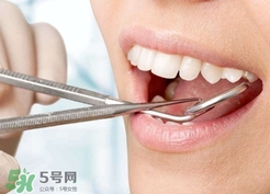 補牙洞需要打麻藥嗎?補牙洞要不要打麻藥? 補牙洞需要打麻藥嗎?補牙洞要不要打麻藥?