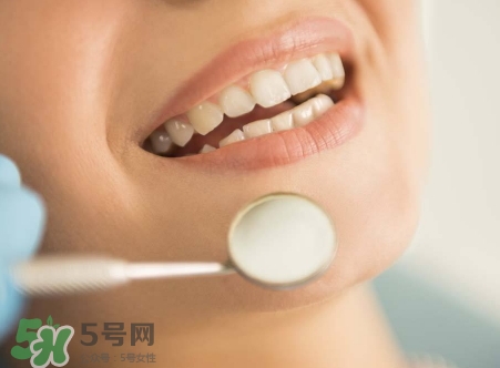 洗牙要多久洗一次?洗牙一般隔多久洗一次? 洗牙要多久洗一次?洗牙一般隔多久洗一次?