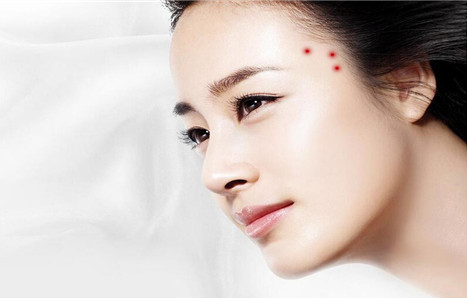 太陽穴長痘怎么回事？為什么太陽穴附近會(huì)長痘