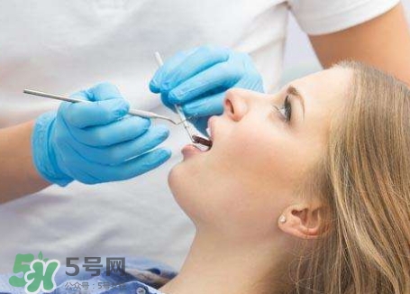 洗牙后牙齒松了怎么辦?洗牙后牙齒松動怎么恢復(fù)? 洗牙后牙齒松了怎么辦?洗牙后牙齒松動怎么恢復(fù)?