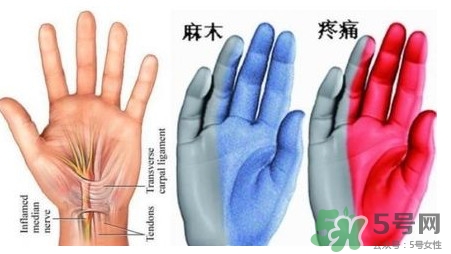 手腳發(fā)麻是缺鈣嗎？手腳發(fā)麻是不是缺鈣