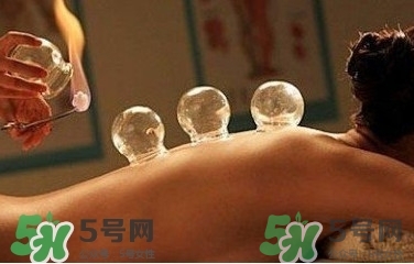 拔火罐疼嗎？拔火罐疼不疼