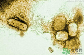 李斯特菌腦炎是什么病?李斯特菌腦炎能治好嗎? 李斯特菌腦炎是什么病?李斯特菌腦炎能治好嗎?