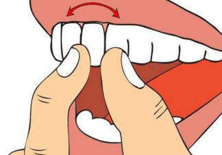 牙齒松動(dòng)是腎虛嗎？牙齒松動(dòng)腎陰虛還是陽(yáng)虛