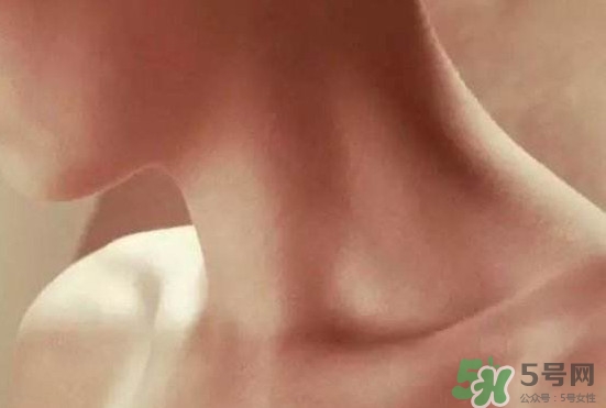 頸椎老化是什么??？頸椎老化的癥狀