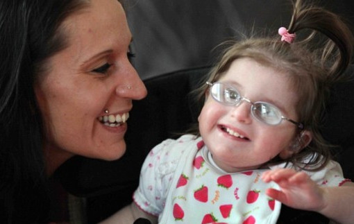 什么是早衰癥？早衰癥初期癥狀