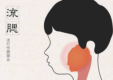 流行性腮腺炎有哪些癥狀？流行性腮腺炎的癥狀