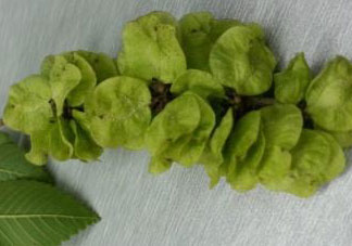 榆錢(qián)可以和什么一起吃?榆錢(qián)不能和什么一起吃?