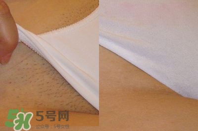 脫毛膏脫完了還會長嗎?脫毛膏脫完有毛茬怎么辦? 脫毛膏脫完了還會長嗎?脫毛膏脫完有毛茬怎么辦?