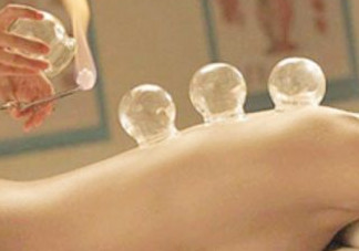 刮痧后可以拔罐嗎？刮痧后能拔火罐嗎