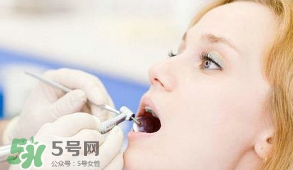 牙齒松動能自己恢復(fù)嗎？牙齒松動會自己恢復(fù)嗎