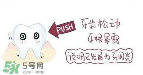 牙齒松動能自己恢復(fù)嗎？牙齒松動會自己恢復(fù)嗎