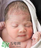 奶癬可以用奶水去除嗎？奶癬可以用奶水擦嗎？