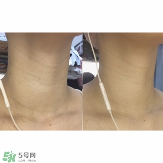 悅薇適合什么年齡？資生堂悅薇適合年齡段