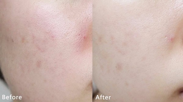 春雨黃油面膜貼怎么用？春雨黃油面膜使用方法