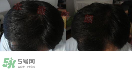  資生堂不老林洗發(fā)水怎么樣？資生堂不老林洗發(fā)水能長頭發(fā)嗎